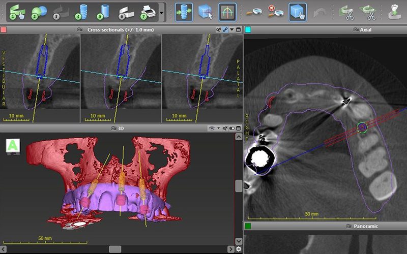 digital dentistry CAD CAM
